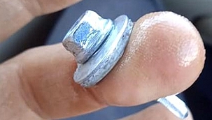 Çankırı'ya Çalışmaya Gelen İşçi İş Kazası Yaşadı